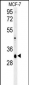 VTI1B Antibody (Center)